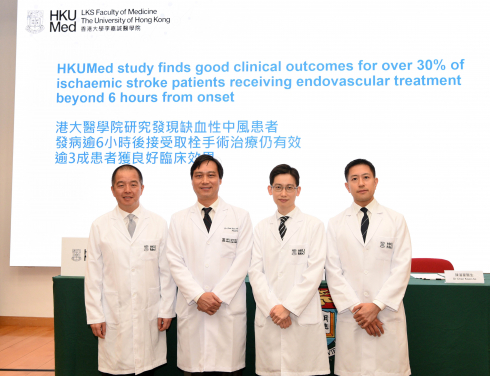 HKUMed research team finds that over 30% of ischaemic stroke patients who received intra-arterial mechanical thrombectomy had a good clinical outcome even after six hours of the onset of symptoms. (From left) Professor Gilberto Leung Ka-kit, Dr Chan Koon-ho, Dr Kevin Cheng King-fai and Dr Edward Chu Yin-lun.
 